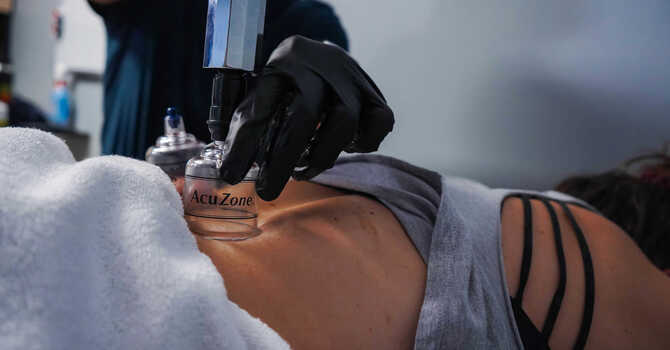 MYOFASCIAL DECOMPRESSION